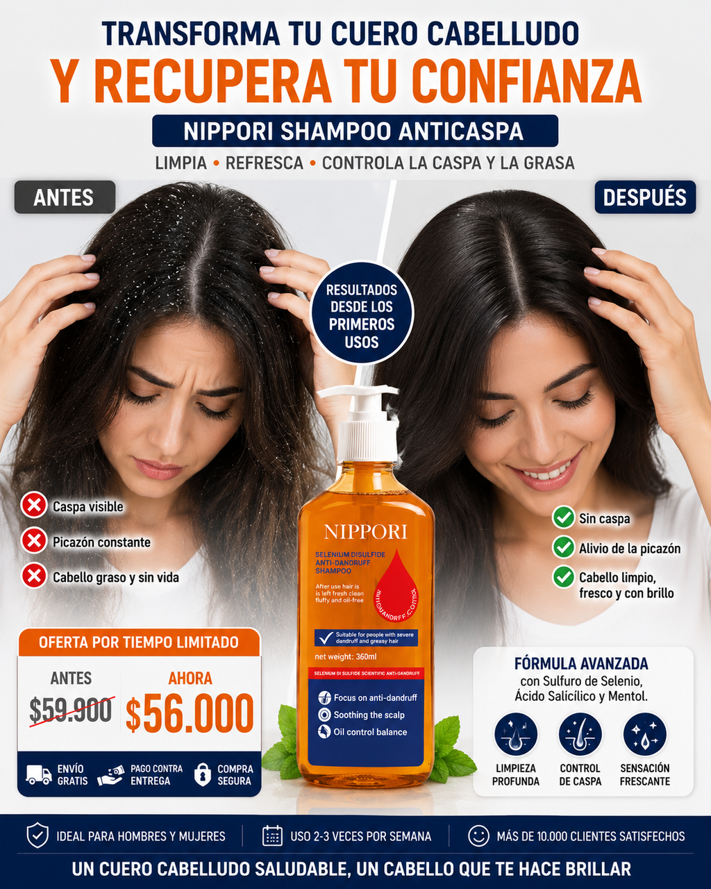 NIPPORI Shampoo Anticaspa 360 ML